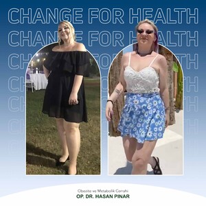 Image of Before and after obesity surgery