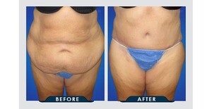 Image of Healthy Life Bariatrics Gallery 0