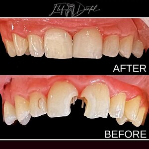 Image of Elif Dental Clinic Gallery 0