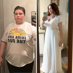 Image of Before and after weight loss surgery