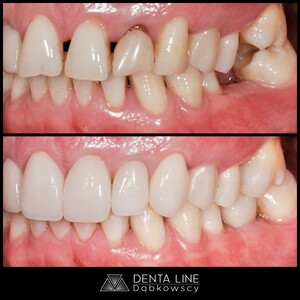 Image of Denta-Line Gallery 2