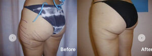 Image of Linia Cosmetic Surgery Gallery 3