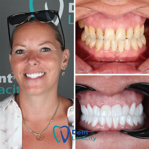 Image of Dent Laracity Dental Clinic Gallery 3