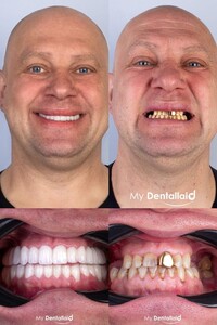 Image of Dentallaid Gallery 0