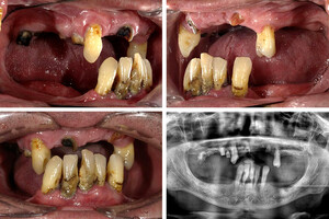 Image of Ortoimplant Dent Spa Gallery 0