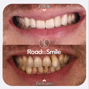 Image of Road to Smile Gallery 3