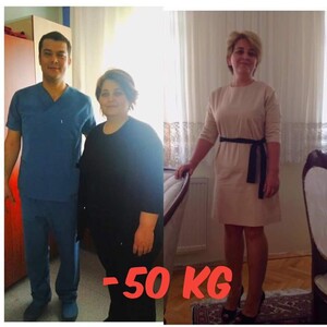 Image of Weight loss surgery before and after