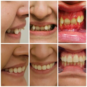 Image of Dentium Implant Center Gallery 0