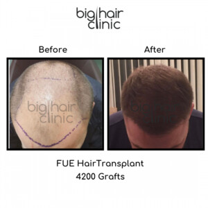 Image of Big Hair Clinic Gallery 0