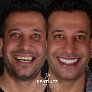 Image of Aesthetic dentistry