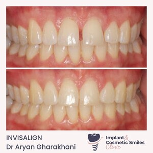 Image of The Implant and Cosmetic Smiles Clinic Gallery 3