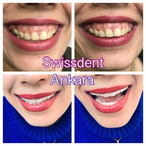 Image of Swiss Dent Oral and Dental Health Polyclinic Gallery 2