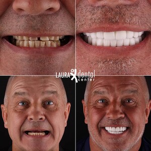 Image of Laura Dental Center Turkey Gallery 3