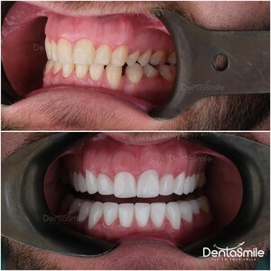 Image of DentaSmile Turkey Gallery 0