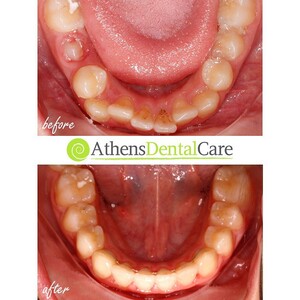 Image of Athens Dental Care Gallery 1