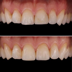 Image of Aesthetic dentistry