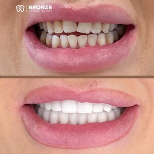 Image of Bronze Dental Clinic Gallery 0