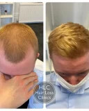 Image of Hair Loss Clinics Gallery 2