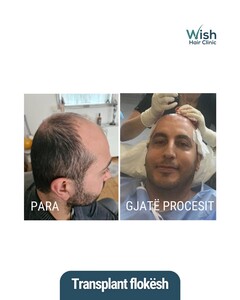 Image of Wish Hair Clinic Gallery 3