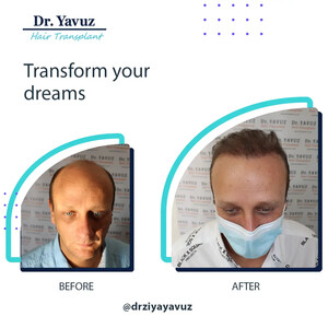 Image of Doctor Ziya Yavuz Hair Transplant Clinic Gallery 0