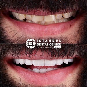 Image of Istanbul Dental Center Gallery 3