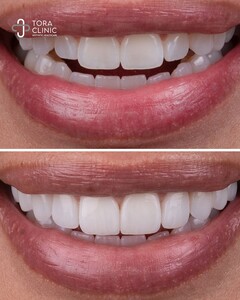 Image of Smile makeover