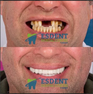 Image of Esdent Dental Centre Gallery 0