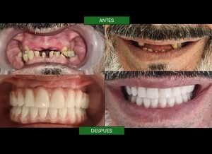 Image of Smile Makeover