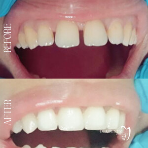 Image of Dental treatment