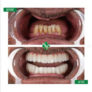 Image of ReGenesis Dental Clinic Turkey Gallery 1