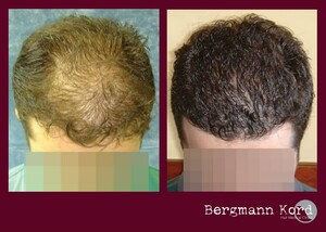 Image of Bergmann Kord Hair Clinic Gallery 0