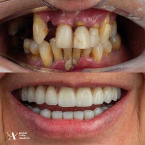 Image of Digital smile design