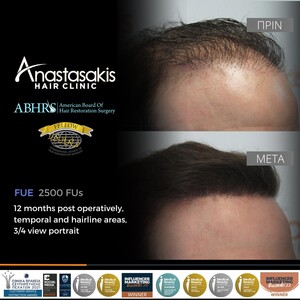 Image of Anastasakis Hair Clinic Gallery 0