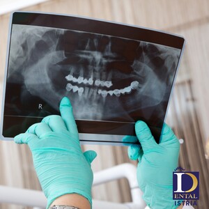 Image of Dental X-Ray - Dental Fiume