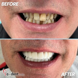 Image of A-dent Dental clinic Gallery 2