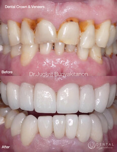 Image of Phuket Dental Signature Gallery 2