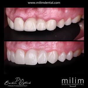 Image of Milim Dental Gallery 2