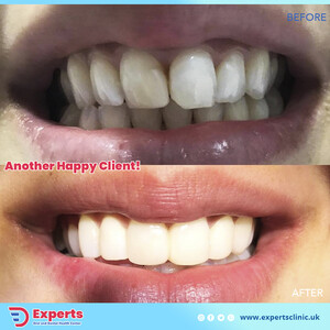 Image of Experts Dental Clinic Gallery 0