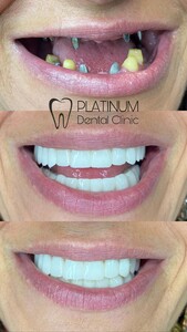 Image of Platinum Dental Clinic Gallery 2