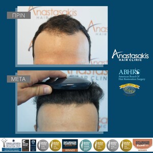 Image of Anastasakis Hair Clinic Gallery 3