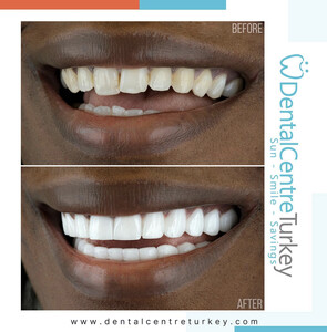 Image of Dental Centre Turkey Gallery 1