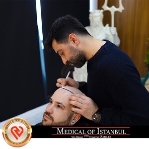 Image of Medical of Istanbul HairTransplant Gallery 1