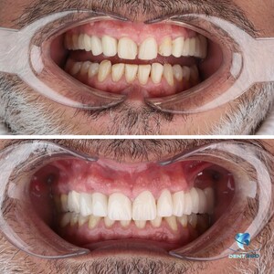 Image of Dental treatment 