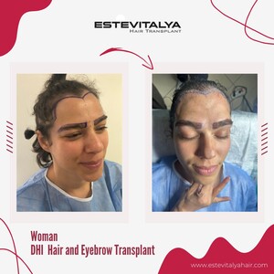 Image of Estevitalya Hair Gallery 3