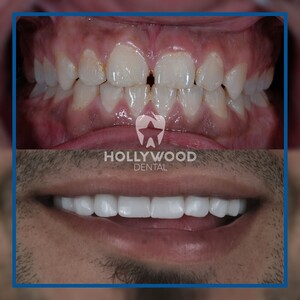 Image of Hollywood Dental Izmir Gallery 1