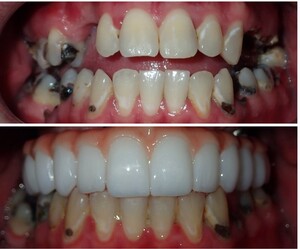 Image of Smile makeover