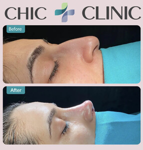 Image of Chic Clinic Istanbul Gallery 1