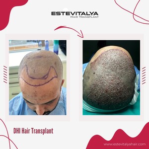 Image of Estevitalya Hair Gallery 2