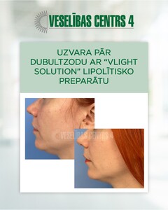 Image of VLight Solution - Dermatology Clinic