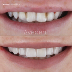 Image of Avedent Dental Clinic Turkey Gallery 3